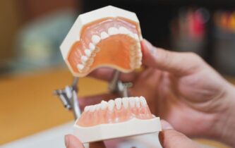 富山のオールオン4メンテナンス｜費用・通院頻度・ケア内容を解説